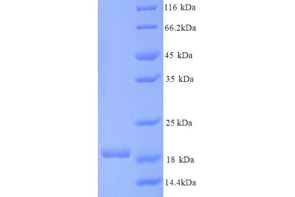 CNKSR2 Protein (AA 650-800) (His tag)