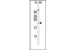Image no. 3 for anti-Phospholipase A2, Group IIC (PLA2G2C) (AA 121-149), (C-Term) antibody (ABIN954161)