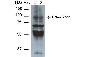 Image no. 3 for anti-Sodium Channel, Nonvoltage-Gated 1 alpha (SCNN1A) (AA 46-68) antibody (HRP) (ABIN5066870)