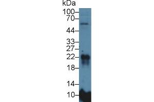 Image no. 2 for anti-Microfibrillar Associated Protein 5 (MFAP5) (AA 32-164) antibody (ABIN1859805)