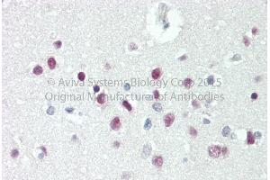 Image no. 2 for anti-T-Box 15 (TBX15) (C-Term) antibody (ABIN2783113)