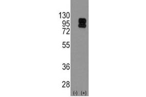 Image no. 9 for anti-CD19 Molecule (CD19) (AA 143-172) antibody (ABIN3030362)