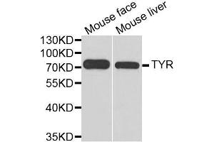 Image no. 2 for anti-Tyrosinase (TYR) antibody (ABIN3021852)