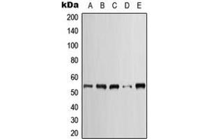 Image no. 1 for anti-Keratin 7 (KRT7) (C-Term) antibody (ABIN2704708)