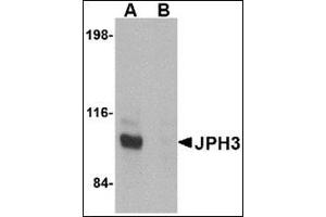 Image no. 2 for anti-Junctophilin 3 (JPH3) (C-Term) antibody (ABIN500100)