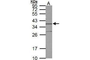 Image no. 4 for anti-Syntaxin 5 (STX5) (Center) antibody (ABIN2856972)