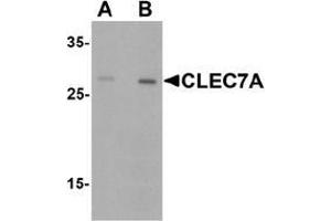 Western blot analysis of CLEC7A in rat spleen tissue lysate with CLEC7A antibody at (A) 1 and (B) 2 µg/.