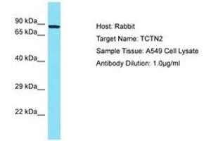 Image no. 1 for anti-Tectonic Family Member 2 (TCTN2) (AA 85-134) antibody (ABIN6750681)