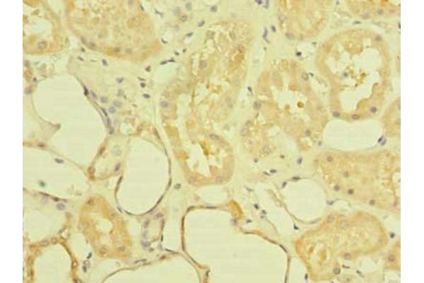 ST6GALNAC6 anticorps  (AA 65-333)