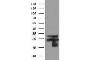 Image no. 5 for anti-Prefoldin Subunit 3 (PFDN3) antibody (ABIN1501706)