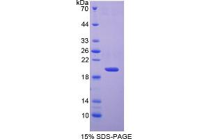 Image no. 1 for Superoxide Dismutase 1, Soluble (SOD1) (AA 2-154) protein (His tag) (ABIN6238004)