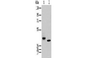 Western blot analysis of Human fetal brain tissue and Human kidney tissue using IDO2 Polyclonal Antibody at dilution of 1:450