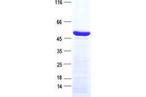 Image no. 1 for Proprotein Convertase Subtilisin/kexin Type 1 (PCSK1) protein (His tag) (ABIN2729761)