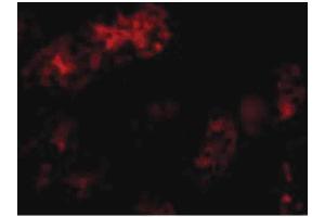 Image no. 2 for anti-Bcl2 Modifying Factor (BMF) (C-Term) antibody (ABIN6655087)
