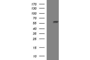 Image no. 3 for anti-Tubulin, alpha 1a (Tuba1a) antibody (ABIN2715957)