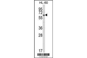 Image no. 1 for anti-Cytochrome P450, Family 51, Subfamily A, Polypeptide 1 (CYP51A1) (AA 250-279) antibody (ABIN652820)