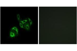 Image no. 1 for anti-Solute Carrier Family 27 (Fatty Acid Transporter), Member 4 (SLC27A4) (AA 61-110) antibody (ABIN1535005)