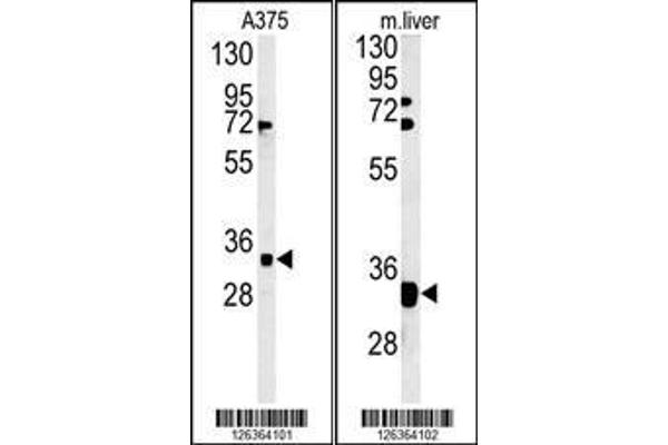 anti-Forty-Two-Three Domain Containing 1 (FYTTD1) (AA 26-54), (N-Term) antibody
