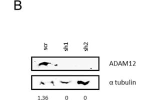 Image no. 4 for anti-ADAM Metallopeptidase Domain 12 (ADAM12) antibody (ABIN6136521)