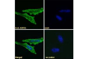 Image no. 2 for anti-Adrenergic, beta-1-, Receptor (ADRB1) (Internal Region) antibody (ABIN185584)