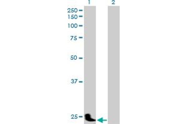 PSG11 抗体  (AA 1-219)