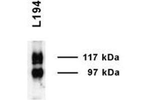 Image no. 1 for anti-Solute Carrier Family 14 (Urea Transporter, Kidney) Member 2 (SLC14A2) (AA 911-929) antibody (ABIN863205)