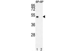 Image no. 5 for anti-E2F Transcription Factor 1 (E2F1) (AA 342-371) antibody (ABIN3030786)
