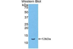 Image no. 1 for anti-Vitronectin (VTN) (AA 19-111) antibody (ABIN1174143)