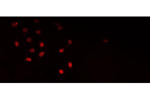 Image no. 2 for anti-ELAV (Embryonic Lethal, Abnormal Vision, Drosophila)-Like 1 (Hu Antigen R) (ELAVL1) antibody (ABIN6261510)