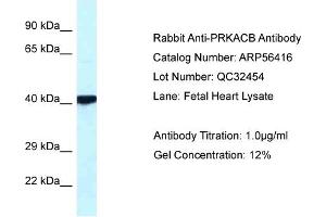 Image no. 1 for anti-Protein Kinase, CAMP Dependent, Catalytic, beta (PRKACB) (Middle Region) antibody (ABIN2786691)
