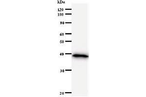 Image no. 1 for anti-BRCA1 Interacting Protein C-terminal Helicase 1 (BRIP1) (C-Term) antibody (ABIN931007)