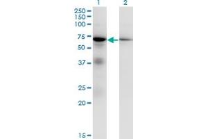 Image no. 7 for anti-Eukaryotic Translation Initiation Factor 2-alpha Kinase 2 (EIF2AK2) (AA 1-100) antibody (ABIN562440)