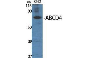 Image no. 2 for anti-ATP-Binding Cassette, Sub-Family D (Ald), Member 4 (ABCD4) (Internal Region) antibody (ABIN3183118)