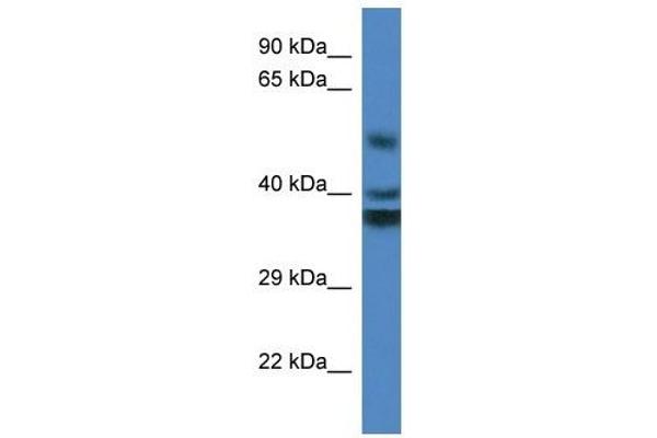 anti-Reticulon 4 Interacting Protein 1 (RTN4IP1) (Middle Region) antibody