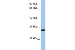 Image no. 3 for anti-Voltage-Dependent Anion Channel 3 (VDAC3) (N-Term) antibody (ABIN2776182)
