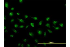 Immunofluorescence of monoclonal antibody to ZIC4 on HeLa cell.