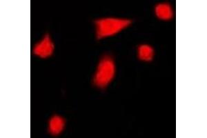 Image no. 1 for anti-Diacylglycerol Kinase, iota (DGKI) (C-Term) antibody (ABIN2957547)
