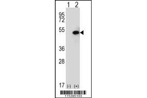 Image no. 2 for anti-Sphingosine Kinase 1 (SPHK1) (C-Term) antibody (ABIN2503463)
