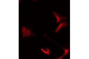 Image no. 2 for anti-Protein Kinase, AMP-Activated, gamma 1 Non-Catalytic Subunit (PRKAG1) (C-Term) antibody (ABIN6259160)
