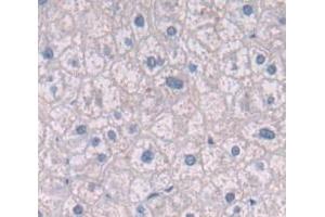 Image no. 2 for anti-Integrin beta 4 (ITGB4) (AA 923-1197) antibody (ABIN1859507)