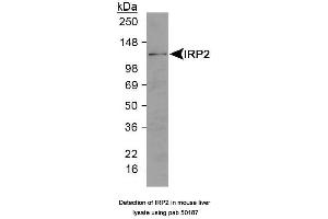 Image no. 1 for anti-Iron-Responsive Element Binding Protein 2 (IREB2) (N-Term) antibody (ABIN363496)