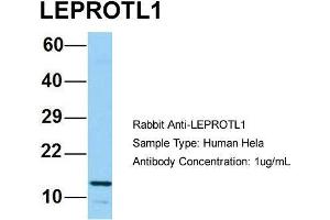 Image no. 1 for anti-Leptin Receptor Overlapping Transcript-Like 1 (LEPROTL1) (N-Term) antibody (ABIN2790809)