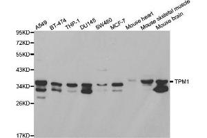 Image no. 2 for anti-Tropomyosin 1 (Alpha) (TPM1) antibody (ABIN3021578)