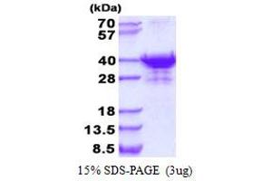 Image no. 1 for UTP23, Small Subunit (SSU) Processome Component, Homolog (UTP23) protein (His tag) (ABIN1098408)
