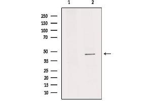 Image no. 1 for anti-Interleukin 11 Receptor, alpha (IL11RA) (C-Term) antibody (ABIN6257607)