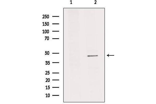 anti-Interleukin 11 Receptor, alpha (IL11RA) (C-Term) antibody