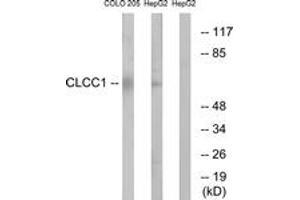 Image no. 1 for anti-Chloride Channel CLIC-Like 1 (CLCC1) (AA 391-440) antibody (ABIN1534765)