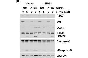 Image no. 20 for anti-Sequestosome 1 (SQSTM1) (Internal Region) antibody (ABIN2854836)