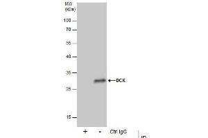 Image no. 4 for anti-Deoxycytidine Kinase (DCK) (Center) antibody (ABIN2855484)