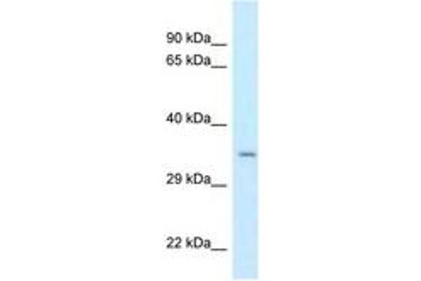 Cpped1 Antikörper  (AA 194-243)